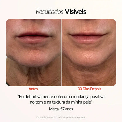 Certaskin Glow Pro 4-em-1